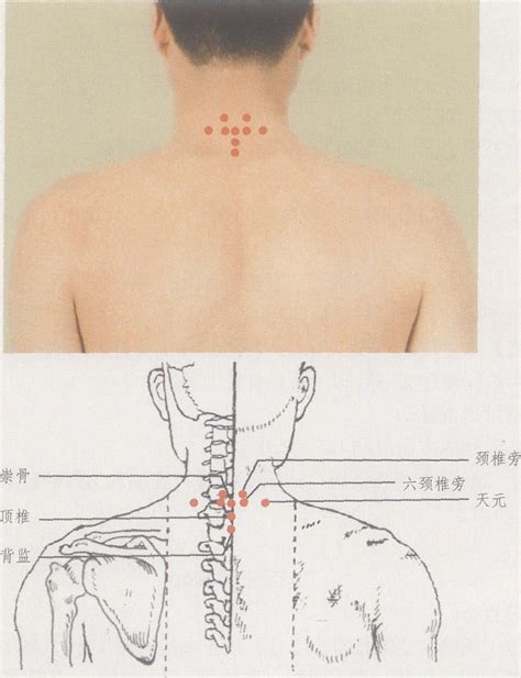 天元穴|天元穴位在什么位置